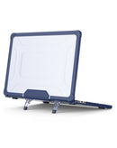 Encuentra la tapa superior Starry shockproof navy blue para MacBook Pro 16 en Guatemala con SlowBack, ideal para proteger tu dispositivo.
