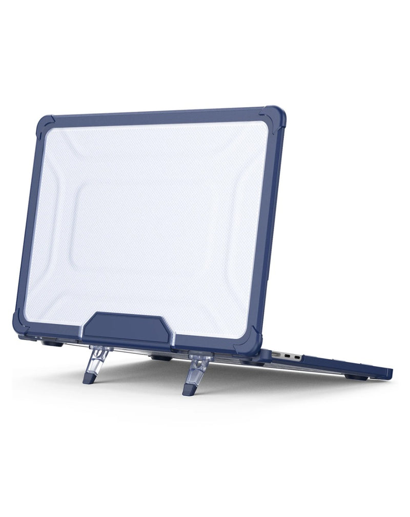 Encuentra la tapa superior Starry shockproof navy blue para MacBook Pro 16 en Guatemala con SlowBack, ideal para proteger tu dispositivo.